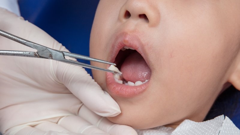 دندانهای شیری و بزرگسال -درمانگاه دندانپزشکی آپادانا